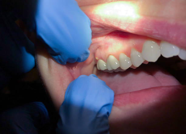 Trusted GA Emergency Dental Service Experts