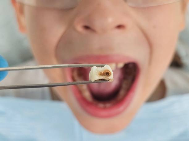 Best Emergency Treatment for Oral Infections in Tyrone, GA